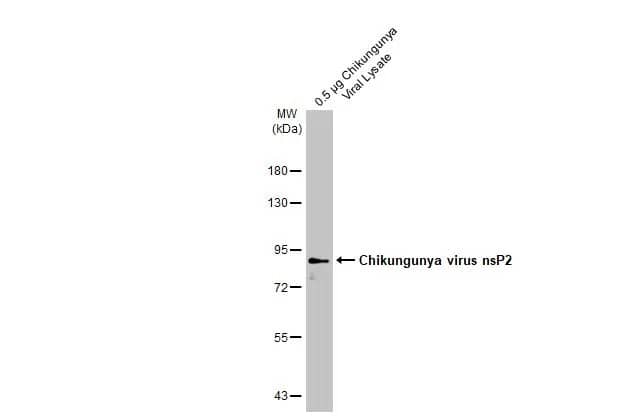 Western Blot: Chikungunya Virus nsp2 Antibody (HL1431) - Azide and BSA Free [NBP3-25409] - Chikungunya Viral Lysate (0.5 ug) was separated by 7.5% SDS-PAGE, and the membrane was blotted with Chikungunya virus nsP2 antibody [HL1431] (NBP3-25409) diluted at 1:20000. The HRP-conjugated anti-rabbit IgG antibody was used to detect the primary antibody.