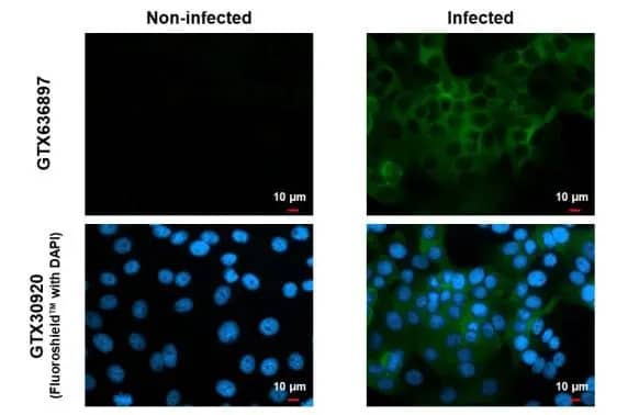 Immunocytochemistry/Immunofluorescence: Chikungunya Virus nsp2 Antibody (HL1431) - Azide and BSA Free [NBP3-25409] - Immunofluorescent analysis of mock and Chikungunya virus-infected cells using Chikungunya virus nsP2 antibody (NBP3-25409). Sample: mock and Chikungunya virus non-infected and infected cells slide. Green: Chikungunya virus nsP2 antibody (NBP3-25409) diluted at 1:100. Blue: Fluoroshield with DAPI .