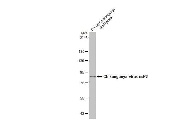 Chikungunya viral lysate (0.1 ug) was separated by 7.5% SDS-PAGE, and the membrane was blotted with Chikungunya virus nsP2 antibody [HL1431] (NBP3-25409) diluted at 1:20000. The HRP-conjugated anti-rabbit IgG antibody  was used to detect the primary antibody, and the signal was developed with Trident ECL plus-Enhanced. 
