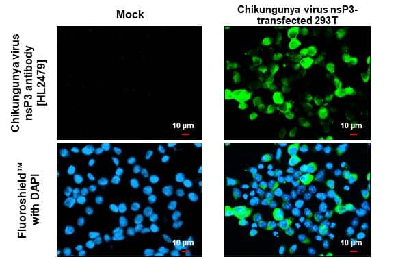 Chikungunya virus nsP3 antibody [HL2479] detects Chikungunya virus nsP3 protein by immunofluorescent analysis.Sample: Mock and transfected 293T cells were fixed in ice-cold MeOH for 5 min.Green: Chikungunya virus nsP3 stained by Chikungunya virus nsP3 antibody [HL2479] (NBP3-25411) diluted at 1:500.Blue: Fluoroshield with DAPI .Scale bar= 10um. 