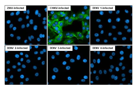 Immunofluorescent analysis of Chikungunya virus infected cells using Chikungunya virus nsP3 antibody [HL2479] antibody (NBP3-25411).Sample: Multiple virus infected cells slide.Green: Chikungunya virus nsP3 antibody [HL2479] antibody (NBP3-25411) diluted at 1:100.Blue: Fluoroshield with DAPI . 