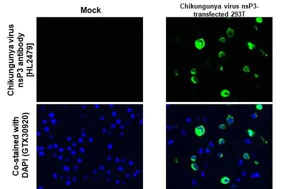 Chikungunya virus nsP3 antibody [HL2479] detects Chikungunya virus nsP3 protein at cytoplasm by immunohistochemical analysis.Sample: Paraffin-embedded mock and Chikungunya virus nsP3 - transfected 293T cell pellet.Green: Chikungunya virus nsP3 stained by Chikungunya virus nsP3 antibody [HL2479] (NBP3-25411) diluted at 1:1000.Blue: Fluoroshield with DAPI .Antigen Retrieval: Citrate buffer, pH 6.0, 15 min 