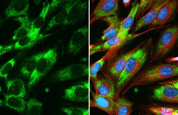 COL4A1 antibody [HL1351] detects COL4A1 protein at vesicle by immunofluorescent analysis.Sample: SK-N-SH cells were fixed in 4% paraformaldehyde at RT for 15 min.Green: COL4A1 stained by COL4A1 antibody [HL1351] (NBP3-25416) diluted at 1:500.Red: alpha Tubulin, a cytoskeleton marker, stained by alpha Tubulin antibody [GT114]  diluted at 1:1000.Blue: Fluoroshield with DAPI . 