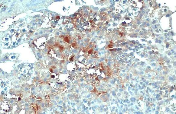COL4A1 antibody [HL1351] detects COL4A1 protein at cell membrane and secreted by immunohistochemical analysis.Sample: Paraffin-embedded mouse placenta.COL4A1 stained by COL4A1 antibody [HL1351] (NBP3-25416) diluted at 1:100.Antigen Retrieval: Citrate buffer, pH 6.0, 15 min 