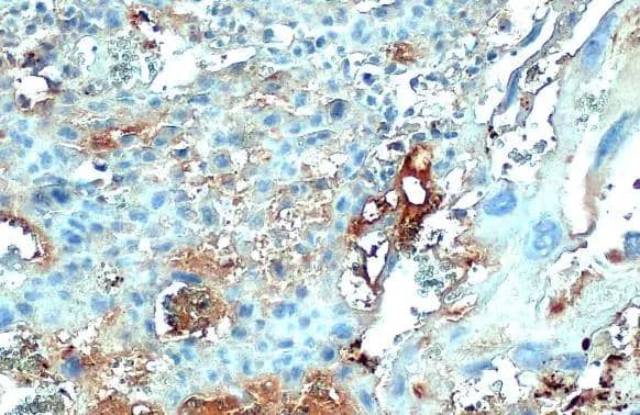 COL4A1 antibody [HL1351] detects COL4A1 protein at cell membrane and secreted by immunohistochemical analysis.Sample: Paraffin-embedded mouse placenta.COL4A1 stained by COL4A1 antibody [HL1351] (NBP3-25416) diluted at 1:100.Antigen Retrieval: Citrate buffer, pH 6.0, 15 min 