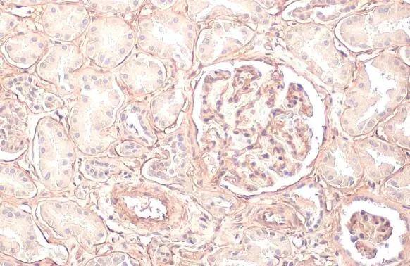 COL4A1 antibody [HL1351] detects COL4A1 protein at cell membrane by immunohistochemical analysis.Sample: Paraffin-embedded human kidney.COL4A1 stained by COL4A1 antibody [HL1351] (NBP3-25416) diluted at 1:50.Antigen Retrieval: Citrate buffer, pH 6.0, 15 min 