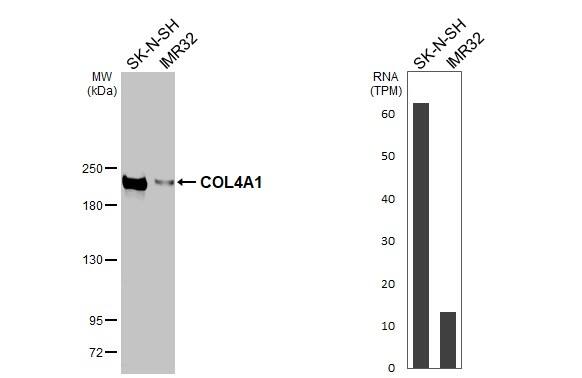 Various whole cell extracts (30 ug) were separated by 5% SDS-PAGE, and the membrane was blotted with COL4A1 antibody [HL1351] (NBP3-25416) diluted at 1:1000. The HRP-conjugated anti-rabbit IgG antibody  was used to detect the primary antibody. Corresponding RNA expression data for the same cell lines are based on Human Protein Atlas program. 