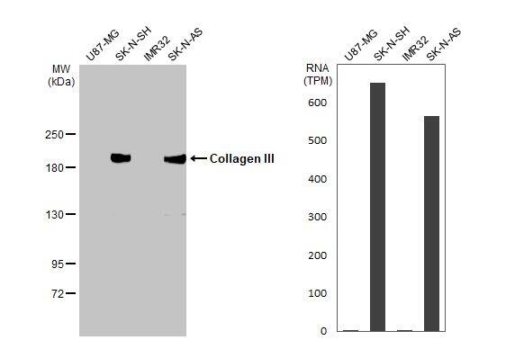 Various whole cell extracts (30 ug) were separated by 5% SDS-PAGE, and the membrane was blotted with Collagen III antibody [HL1906] (NBP3-25419) diluted at 1:1000. The HRP-conjugated anti-rabbit IgG antibody  was used to detect the primary antibody. Corresponding RNA expression data for the same cell lines are based on Human Protein Atlas program. 