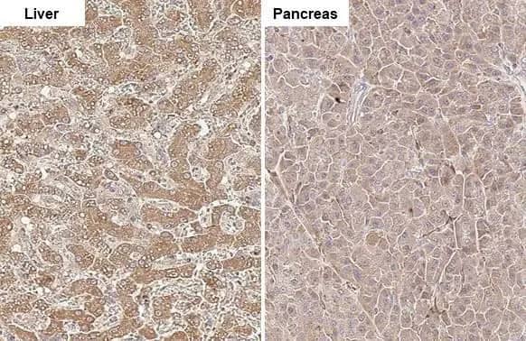 Immunohistochemistry-Paraffin: CPT1A Antibody (HL1164) - Azide and BSA Free [NBP3-25423] - CPT1A antibody [HL1164] detects CPT1A protein at mitochondria by immunohistochemical analysis. Sample: Paraffin-embedded cat tissues. CPT1A stained by CPT1A antibody [HL1164] (NBP3-25423) diluted at 1:100. Antigen Retrieval: Citrate buffer, pH 6.0, 15 min