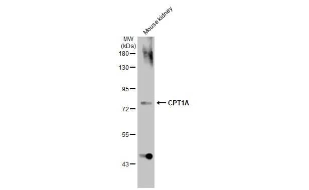 Western Blot: CPT1A Antibody (HL1164) - Azide and BSA Free [NBP3-25423] - Mouse tissue extract (50 ug) was separated by 7.5% SDS-PAGE, and the membrane was blotted with CPT1A antibody [HL1164] (NBP3-25423) diluted at 1:1000. The HRP-conjugated anti-rabbit IgG antibody was used to detect the primary antibody.