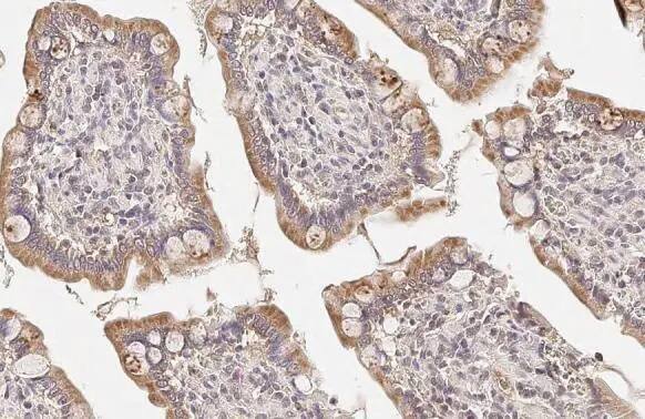 <b>Genetic Strategies Validation. </b>Immunohistochemistry-Paraffin: CPT1A Antibody (HL1164) - Azide and BSA Free [NBP3-25423] - CPT1A antibody [HL1164] detects CPT1A protein at mitochondria by immunohistochemical analysis. Sample: Paraffin-embedded dog intestine. CPT1A stained by CPT1A antibody [HL1164] (NBP3-25423) diluted at 1:100. Antigen Retrieval: Citrate buffer, pH 6.0, 15 min