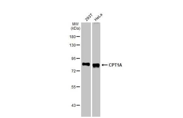 Western Blot: CPT1A Antibody (HL1164) - Azide and BSA Free [NBP3-25423] - Various whole cell extracts (30 ug) were separated by 7.5% SDS-PAGE, and the membrane was blotted with CPT1A antibody [HL1164] (NBP3-25423) diluted at 1:1000. The HRP-conjugated anti-rabbit IgG antibody was used to detect the primary antibody.