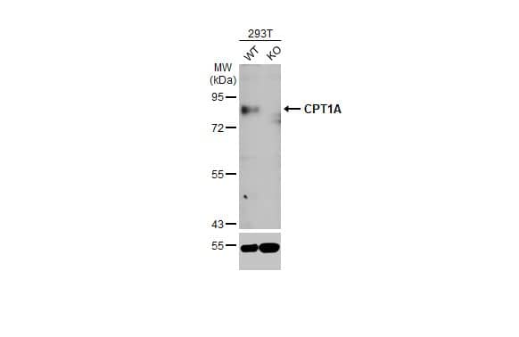 Knockout Validated: CPT1A Antibody (HL1164) - Azide and BSA Free [NBP3-25423] - Wild-type (WT) and CPT1A knockout (KO) 293T cell extracts (30 ug) were separated by 7.5% SDS-PAGE, and the membrane was blotted with CPT1A antibody [HL1164] (NBP3-25423) diluted at 1:1000. The HRP-conjugated anti-rabbit IgG antibody was used to detect the primary antibody, and the signal was developed with Trident ECL plus-Enhanced.