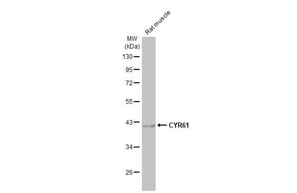 Western Blot: Cyr61/CCN1 Antibody (HL2144) - Azide and BSA Free [NBP3-25430] - Rat tissue extract (50 ug) was separated by 10% SDS-PAGE, and the membrane was blotted with CYR61 antibody [HL2144] (NBP3-25430) diluted at 1:1000. The HRP-conjugated anti-rabbit IgG antibody was used to detect the primary antibody.