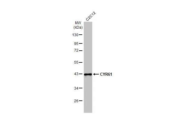 Western Blot: Cyr61/CCN1 Antibody (HL2144) - Azide and BSA Free [NBP3-25430] - Whole cell extract (30 ug) was separated by 10% SDS-PAGE, and the membrane was blotted with CYR61 antibody [HL2144] (NBP3-25430) diluted at 1:1000. The HRP-conjugated anti-rabbit IgG antibody was used to detect the primary antibody, and the signal was developed with Trident ECL plus-Enhanced.