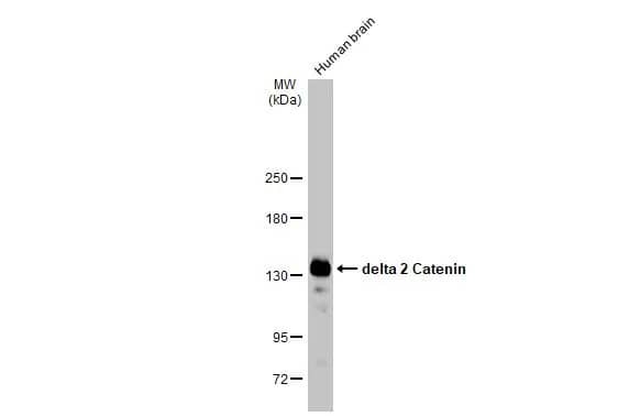 Western Blot: delta 2 Catenin Antibody (HL1629) - Azide and BSA Free [NBP3-25432] - Human tissue extract (30 Aug) was separated by 5% SDS-PAGE, and the membrane was blotted with delta 2 Catenin antibody [HL1629] (NBP3-25432) diluted at 1:1000. The HRP-conjugated anti-rabbit IgG antibody was used to detect the primary antibody.