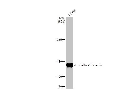 Western Blot: delta 2 Catenin Antibody (HL1629) - Azide and BSA Free [NBP3-25432] - Whole cell extract (30 ug) was separated by 5% SDS-PAGE, and the membrane was blotted with delta 2 Catenin antibody [HL1629] (NBP3-25432) diluted at 1:10000. The HRP-conjugated anti-rabbit IgG antibody was used to detect the primary antibody.