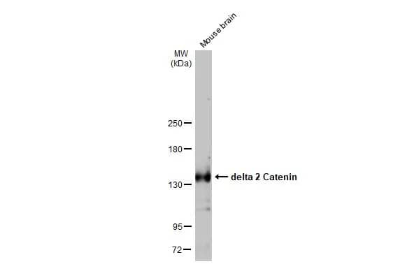 Western Blot: delta 2 Catenin Antibody (HL1629) - Azide and BSA Free [NBP3-25432] - Mouse tissue extract (50 Aug) was separated by 5% SDS-PAGE, and the membrane was blotted with delta 2 Catenin antibody [HL1629] (NBP3-25432) diluted at 1:1000. The HRP-conjugated anti-rabbit IgG antibody was used to detect the primary antibody.