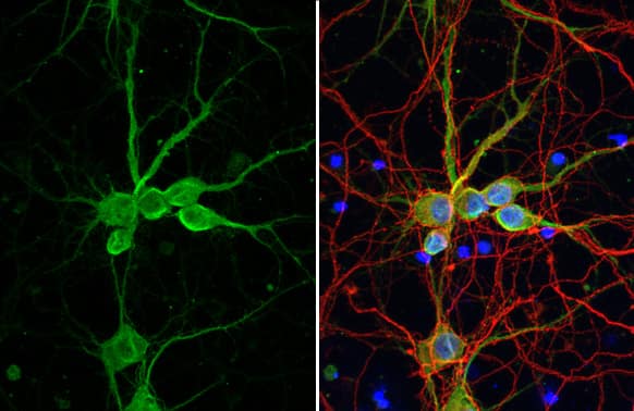 Immunocytochemistry/ Immunofluorescence delta 2 Catenin Antibody (HL1629) - Azide and BSA Free