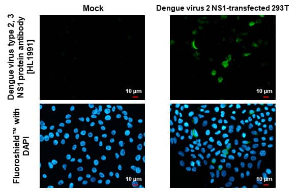 Immunocytochemistry/Immunofluorescence: Dengue Virus NS1 protein Antibody (HL1991) - Azide and BSA Free [NBP3-25434] - Dengue virus type 2, 3 NS1 protein antibody [HL1991] detects Dengue virus type 2 NS1 protein protein by immunofluorescent analysis. Sample: Mock and transfected 293T cells were fixed in 4% paraformaldehyde at RT for 15 min. Green: Dengue virus type 2 NS1 protein stained by Dengue virus type 2, 3 NS1 protein antibody [HL1991] (NBP3-25434) diluted at 1:500. Blue: Fluoroshield with DAPI .