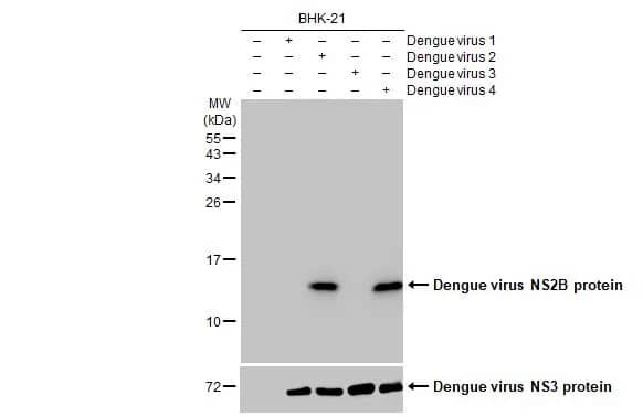 Western Blot: Dengue Virus NS2B Antibody (HL2512) - Azide and BSA Free [NBP3-25435] - Non-infected (-) and infected (+) BHK-21 whole cell extracts (5 ug) were separated by 15% SDS-PAGE, and the membrane was blotted with Dengue virus NS2B protein antibody [HL2512] (NBP3-25435) diluted at 1:1000. The HRP-conjugated anti-rabbit IgG antibody was used to detect the primary antibody.