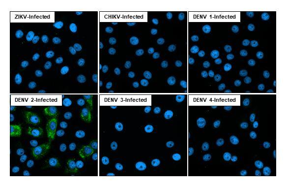 Immunofluorescent analysis of Dengue virus infected cells using Dengue virus NS2B protein antibody [HL2512] antibody (NBP3-25435).Sample: Multiple virus infected cells slide.Green: Dengue virus NS2B protein antibody [HL2512] antibody (NBP3-25435) diluted at 1:100.Blue: Fluoroshield with DAPI . 