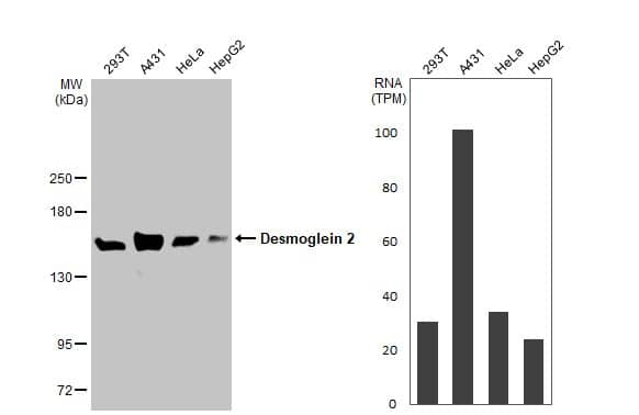 <b>Orthogonal Strategies Validation. </b>Western Blot: Desmoglein-2 Antibody (HL2036) - Azide and BSA Free [NBP3-25438] - Various whole cell extracts (30 ug) were separated by 5% SDS-PAGE, and the membrane was blotted with Desmoglein 2 antibody [HL2036] (NBP3-25438) diluted at 1:5000. The HRP-conjugated anti-rabbit IgG antibody was used to detect the primary antibody. Corresponding RNA expression data for the same cell lines are based on Human Protein Atlas program.