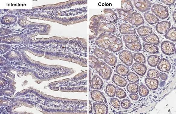 Immunohistochemistry-Paraffin: Desmoglein-2 Antibody (HL2036) - Azide and BSA Free [NBP3-25438] - Desmoglein 2 antibody [HL2036] detects Desmoglein 2 protein by immunohistochemical analysis. Sample: Paraffin-embedded mouse tissue. Desmoglein 2 stained by Desmoglein 2 antibody [HL2036] (NBP3-25438) diluted at 1:100. Antigen Retrieval: Citrate buffer, pH 6.0, 15 min