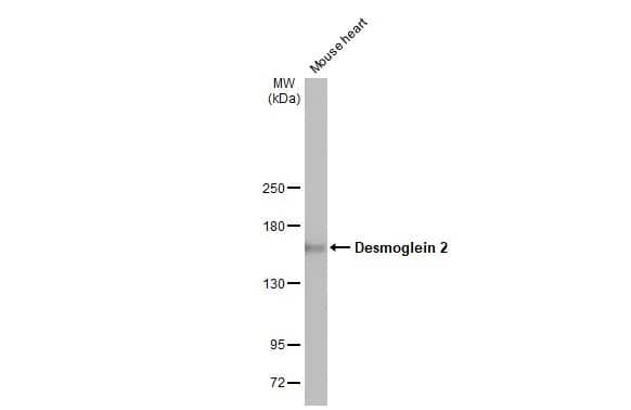 Western Blot: Desmoglein-2 Antibody (HL2036) - Azide and BSA Free [NBP3-25438] - Mouse tissue extract (50 ug) was separated by 5% SDS-PAGE, and the membrane was blotted with Desmoglein 2 antibody [HL2036] (NBP3-25438) diluted at 1:1000. The HRP-conjugated anti-rabbit IgG antibody was used to detect the primary antibody.