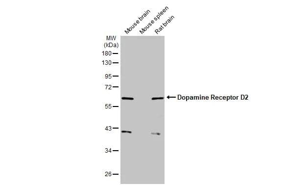 Various tissue extracts (50 ug) were separated by 10% SDS-PAGE, and the membrane was blotted with Dopamine Receptor D2 antibody [HL1584] (NBP3-25444) diluted at 1:1000. The HRP-conjugated anti-rabbit IgG antibody  was used to detect the primary antibody. 
