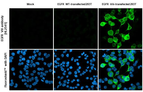 Immunocytochemistry/Immunofluorescence: EGFR Antibody (HL2541) - EGFRvIII, Mutant - Azide and BSA Free [NBP3-25446] - EGFR VIII antibody [HL2541] detects EGFR VIII protein by immunofluorescent analysis. Sample: Mock and transfected 293T cells were fixed in 4% paraformaldehyde at RT for 15 min. Green: EGFR VIII stained by EGFR VIII antibody [HL2541] (NBP3-25446) diluted at 1:500. Blue: Fluoroshield with DAPI .