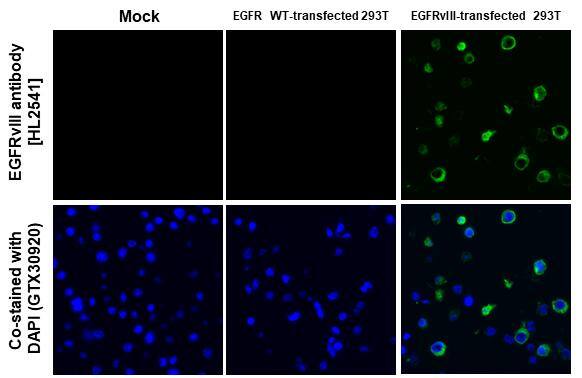 EGFRvIII antibody [HL2541] detects EGFRvIII protein by immunohistochemical analysis.Sample: EGFRvIII transfected 293T cell FFPE Cell Pellet Block.Green: EGFRvIII stained by EGFRvIII antibody [HL2541] (NBP3-25446) diluted at 1:1000.Blue: Fluoroshield with DAPI .Antigen Retrieval: Citrate buffer, pH 6.0, 15 min 