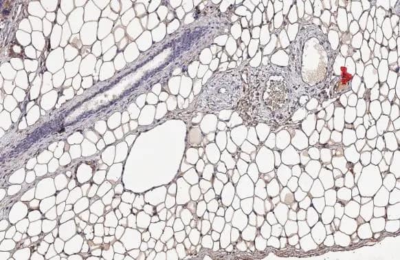 <b>Orthogonal Strategies Validation. </b>Immunohistochemistry-Paraffin: Monoglyceride Lipase Antibody (HL1938) - Azide and BSA Free [NBP3-25448] - Monoglyceride lipase antibody [HL1938] detects Monoglyceride lipase protein at cell membrane and cytoplasm by immunohistochemical analysis. Sample: Paraffin-embedded mouse white adipocyte. Monoglyceride lipase stained by Monoglyceride lipase antibody [HL1938] (NBP3-25448) diluted at 1:100. Antigen Retrieval: Citrate buffer, pH 6.0, 15 min