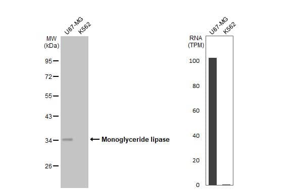 Western Blot: Monoglyceride Lipase Antibody (HL1938) - Azide and BSA Free [NBP3-25448] - Various whole cell extracts (30 ug) were separated by 10% SDS-PAGE, and the membrane was blotted with Monoglyceride lipase antibody [HL1938] (NBP3-25448) diluted at 1:1000. The HRP-conjugated anti-rabbit IgG antibody was used to detect the primary antibody. Corresponding RNA expression data for the same cell lines are based on Human Protein Atlas program.