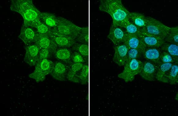 Immunocytochemistry/Immunofluorescence: ELAVL2 Antibody (HL1978) - Azide and BSA Free [NBP3-25449] - ELAVL2 antibody [HL1978] detects ELAVL2 protein at nucleus and cytoskeleton by immunofluorescent analysis. Sample: A431 cells were fixed in ice-cold MeOH for 5 min. Green: ELAVL2 stained by ELAVL2 antibody [HL1978] (NBP3-25449) diluted at 1:500. Red: alpha Tubulin, a cytoskeleton marker, stained by alpha Tubulin antibody [GT114] (NBP2-43837) diluted at 1:1000. Blue: Fluoroshield with DAPI .