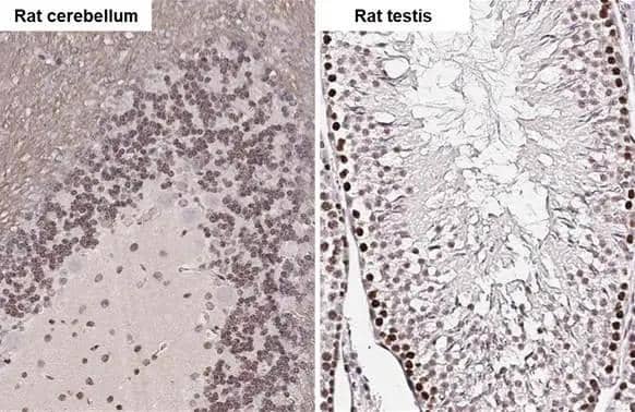 ELAVL2 antibody [HL1978] detects ELAVL2 protein at nucleus by immunohistochemical analysis.Sample: Paraffin-embedded rat tissues.ELAVL2 stained by ELAVL2 antibody [HL1978] (NBP3-25449) diluted at 1:100.Antigen Retrieval: Citrate buffer, pH 6.0, 15 min 