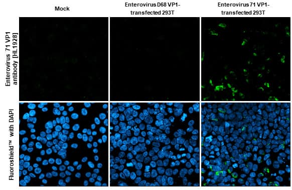 Immunocytochemistry/Immunofluorescence: Enterovirus 71 VP1 Antibody (HL1928) - Azide and BSA Free [NBP3-25450] - Enterovirus 71 VP1 antibody [HL1928] detects Enterovirus 71 VP1 protein by immunofluorescent analysis. Sample: Mock and transfected 293T cells were fixed in 4% paraformaldehyde at RT for 15 min. Green: Enterovirus 71 VP1 stained by Enterovirus 71 VP1 antibody [HL1928] (NBP3-25450) diluted at 1:500. Blue: Fluoroshield with DAPI .