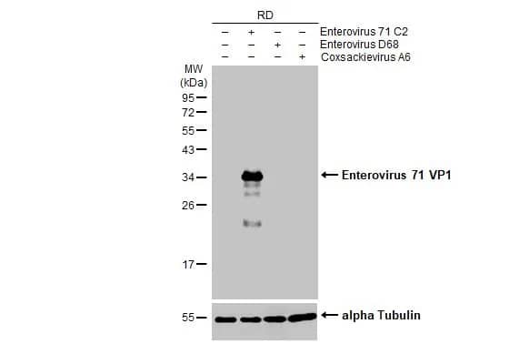 Western Blot: Enterovirus 71 VP1 Antibody (HL1928) - Azide and BSA Free [NBP3-25450] - Non-infected (-) and infected (+) RD whole cell extracts (20 ug) were separated by 12% SDS-PAGE, and the membrane was blotted with Enterovirus 71 VP1 antibody [HL1928] (NBP3-25450) diluted at 1:4000. The HRP-conjugated anti-rabbit IgG antibody was used to detect the primary antibody.