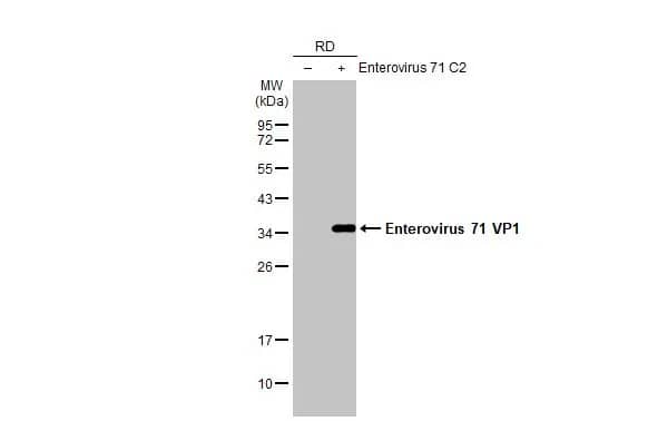 Western Blot: Enterovirus 71 VP1 Antibody (HL1928) - Azide and BSA Free [NBP3-25450] - Non-infected (-) and infected (+) RD whole cell extracts (5 ug) were separated by 12% SDS-PAGE, and the membrane was blotted with Enterovirus 71 VP1 antibody [HL1928] (NBP3-25450) diluted at 1:1000. The HRP-conjugated anti-rabbit IgG antibody was used to detect the primary antibody.