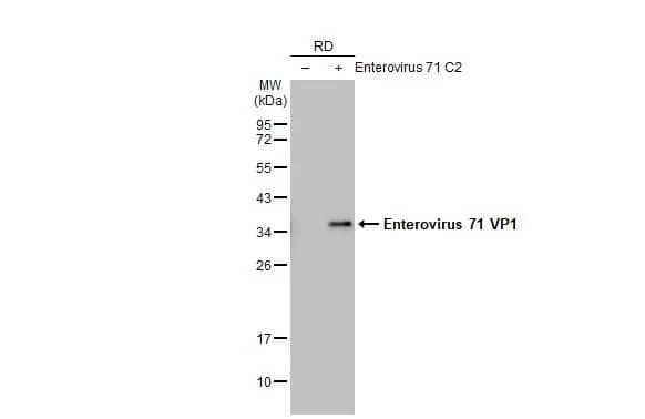 Western Blot: Enterovirus 71 VP1 Antibody (HL1929) - Azide and BSA Free [NBP3-25451] - Non-infected (-) and infected (+) RD whole cell extracts (5 ug) were separated by 12% SDS-PAGE, and the membrane was blotted with Enterovirus 71 VP1 antibody [HL1929] (NBP3-25451) diluted at 1:1000. The HRP-conjugated anti-rabbit IgG antibody was used to detect the primary antibody.