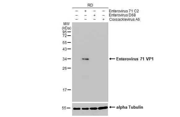 Western Blot: Enterovirus 71 VP1 Antibody (HL1929) - Azide and BSA Free [NBP3-25451] - Non-infected (-) and infected (+) RD whole cell extracts (20 ug) were separated by 12% SDS-PAGE, and the membrane was blotted with Enterovirus 71 VP1 antibody [HL1929] (NBP3-25451) diluted at 1:20000. The HRP-conjugated anti-rabbit IgG antibody was used to detect the primary antibody.