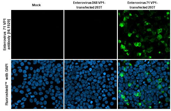 Immunocytochemistry/Immunofluorescence: Enterovirus 71 VP1 Antibody (HL1929) - Azide and BSA Free [NBP3-25451] - Enterovirus 71 VP1 antibody [HL1929] detects Enterovirus 71 VP1 protein by immunofluorescent analysis. Sample: Mock and transfected 293T cells were fixed in 4% paraformaldehyde at RT for 15 min. Green: Enterovirus 71 VP1 stained by Enterovirus 71 VP1 antibody [HL1929] (NBP3-25451) diluted at 1:500. Blue: Fluoroshield with DAPI .