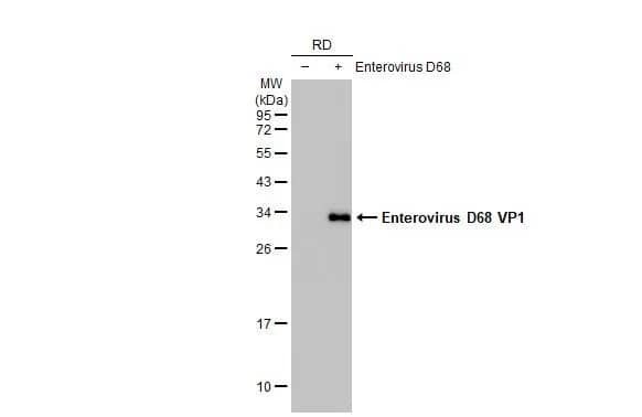 Western Blot: Enterovirus D68 VP1 Antibody (HL1997) - Azide and BSA Free [NBP3-25452] - Non-infected (-) and infected (+) RD whole cell extracts (30 ug) were separated by 12% SDS-PAGE, and the membrane was blotted with Enterovirus D68 VP1 antibody [HL1997] (NBP3-25452) diluted at 1:1000. The HRP-conjugated anti-rabbit IgG antibody was used to detect the primary antibody.