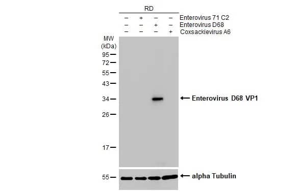 Western Blot: Enterovirus D68 VP1 Antibody (HL1997) - Azide and BSA Free [NBP3-25452] - Non-infected (-) and infected (+) RD whole cell extracts (20 ug) were separated by 12% SDS-PAGE, and the membrane was blotted with Enterovirus D68 VP1 antibody [HL1997] (NBP3-25452) diluted at 1:1000. The HRP-conjugated anti-rabbit IgG antibody was used to detect the primary antibody.