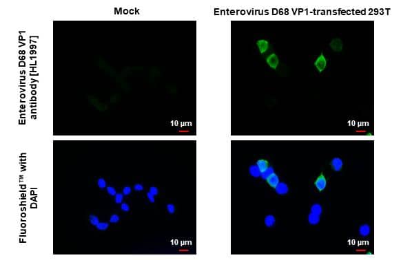 Enterovirus D68 VP1 antibody [HL1997] detects Enterovirus D68 VP1 protein by immunofluorescent analysis.Sample: Mock and transfected 293T cells were fixed in 4% paraformaldehyde at RT for 15 min.Green: Enterovirus D68 VP1 stained by Enterovirus D68 VP1 antibody [HL1997] (NBP3-25452) diluted at 1:2000.Blue: Fluoroshield with DAPI . 