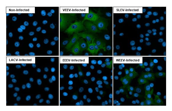 Immunocytochemistry/Immunofluorescence: Equine Encephalitis Virus NSP2 Antibody (HL1920) - Azide and BSA Free [NBP3-25456] - Immunofluorescent analysis of Venezuelan equine encephalitis virus infected cells using Venezuelan Equine Encephalitis Virus nsP2 antibody [HL1920] antibody (NBP3-25456). Sample: Multiple virus infected cells slide. Green: Venezuelan Equine Encephalitis Virus nsP2 antibody [HL1920] antibody (NBP3-25456) diluted at 1:100. Blue: Fluoroshield with DAPI .