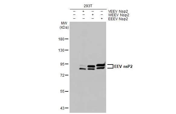 Western Blot: Equine Encephalitis Virus NSP2 Antibody (HL1920) - Azide and BSA Free [NBP3-25456] - Non-transfected (-) and transfected (+) 293T whole cell extracts (30 ug) were separated by 7.5% SDS-PAGE, and the membrane was blotted with Equine Encephalitis Virus nsP2 antibody [HL1920] (NBP3-25456) diluted at 1:5000. The HRP-conjugated anti-rabbit IgG antibody was used to detect the primary antibody, and the signal was developed with Trident ECL plus-Enhanced.