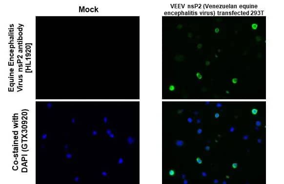 Immunohistochemistry-Paraffin: Equine Encephalitis Virus NSP2 Antibody (HL1920) - Azide and BSA Free [NBP3-25456] - Equine Encephalitis Virus nsP2 antibody [HL1920] detects Equine Encephalitis Virus nsP2 protein by immunohistochemical analysis. Sample: Paraffin-embedded mock and VEEV nsP2 (Venezuelan equine encephalitis virus) - transfected 293T cell pellet. Green: Equine Encephalitis Virus nsP2 stained by Equine Encephalitis Virus nsP2 antibody [HL1920] (NBP3-25456) diluted at 1:5000. Blue: Fluoroshield with DAPI . Antigen Retrieval: Citrate buffer, pH 6.0, 15 min