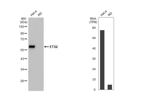 Western Blot: ETS2 Antibody (HL2258) - Azide and BSA Free [NBP3-25457] - Various whole cell extracts (30 ug) were separated by 10% SDS-PAGE, and the membrane was blotted with ETS2 antibody [HL2258] (NBP3-25457) diluted at 1:2000. The HRP-conjugated anti-rabbit IgG antibody was used to detect the primary antibody, and the signal was developed with Trident ECL plus-Enhanced. Corresponding RNA expression data for the same cell lines are based on Human Protein Atlas program.