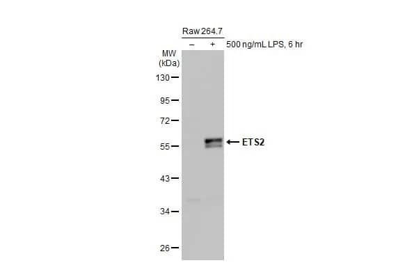 <b>Biological Strategies Validation and Orthogonal Strategies Validation.</b>Western Blot: ETS2 Antibody (HL2258) - Azide and BSA Free [NBP3-25457] - Untreated (-) and treated (+) Raw 264.7 whole cell extracts (30 ug) were separated by 10% SDS-PAGE, and the membrane was blotted with ETS2 antibody [HL2258] (NBP3-25457) diluted at 1:1000. The HRP-conjugated anti-rabbit IgG antibody was used to detect the primary antibody, and the signal was developed with Trident ECL plus-Enhanced.